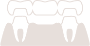 ブリッジイラスト